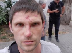 Мужчину избили за улыбку в центре Днепра - рис. 13