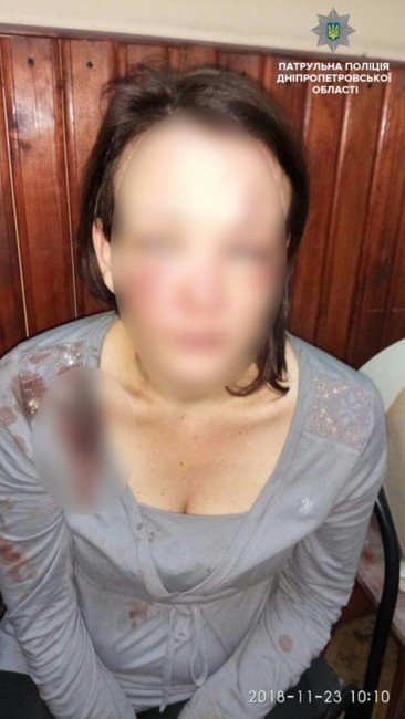 Водитель грузовика под наркотиками избил женщину и выбросил из авто в Днепре - рис. 3