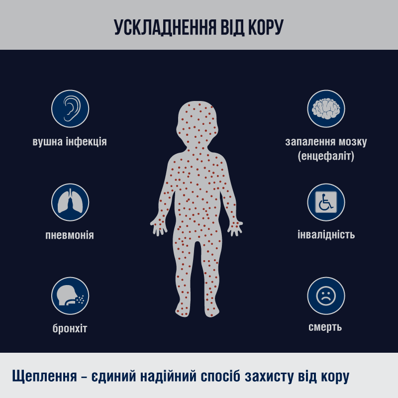 С началом 2019 года в Украине заболело корью около 2 000 человек - рис. 2