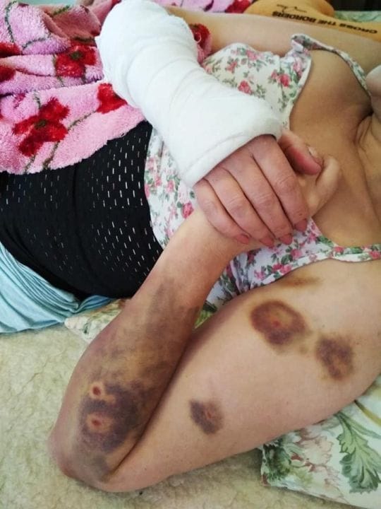 В Днепре стая уличных собак до полусмерти искусала женщину - рис. 8