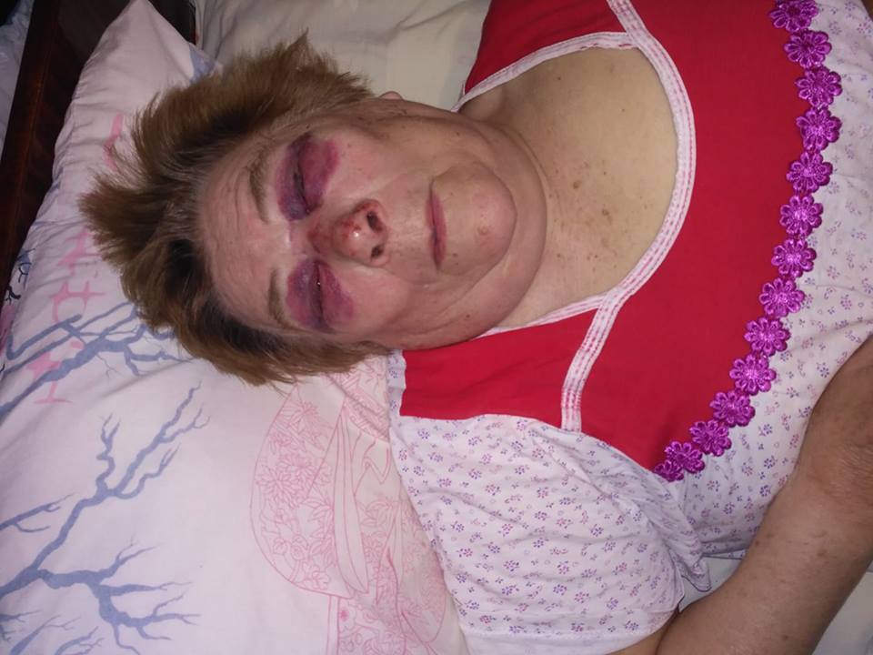 В Днепре среди белого дня мужчина напал на пенсионерку - рис. 19
