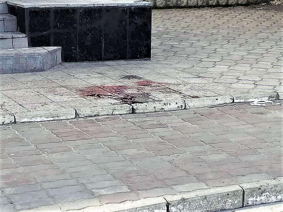 В Каменском подстрелили активиста Евгения Найду - рис. 2