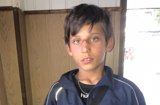 У Дніпрі з лікарні втік 12-річний хлопчик - рис. 1
