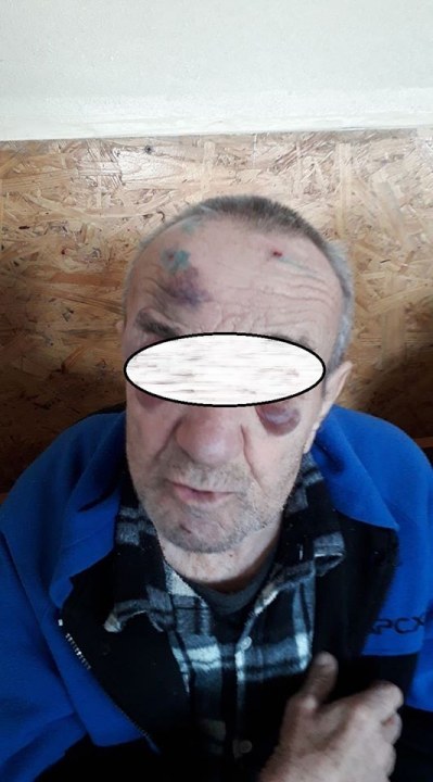 Санитары бьют и насилуют: в областном психоневрологическом диспансере провели проверку - рис. 2