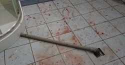 Все залито кровью: иностранец устроил в общежитии поножовщину - рис. 15