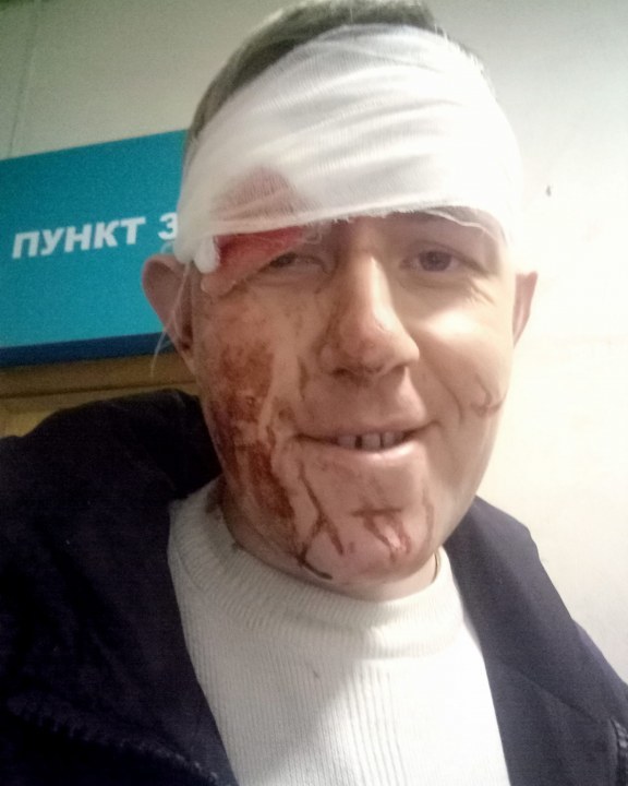 Дмитрий после нападения