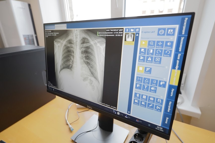 Рентген и флюорография с минимальным вредом для здоровья: в 16-й больнице Днепра появился современный аппарат (ФОТО) - рис. 3