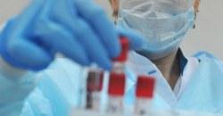 На Днепропетровщине обнаружили еще два случая коронавируса - рис. 9