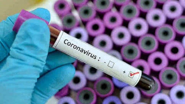 На Днепропетровщине прибавилось 17 новых случаев COVID-19 - рис. 1