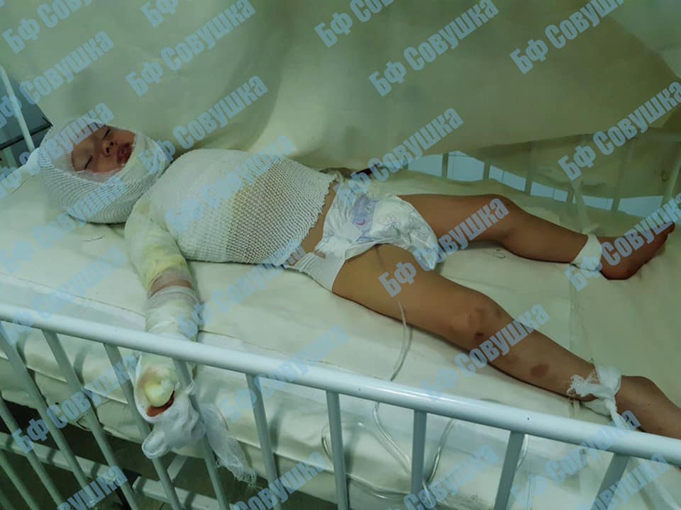 Нужна помощь: в Днепре 2-летний малыш перевернул на себя кружку с кипятком