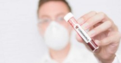 В Украине 433 новых заболевших коронавирусом за сутки - МОЗ - рис. 9