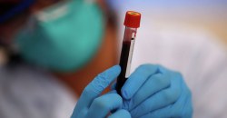 В мире новый рекорд по числу заболевших: какая ситуация с коронавирусом в Украине - рис. 12