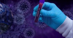 Почти 27 тысяч заболевших коронавирусом в Украине: сколько случаев за сутки - рис. 18