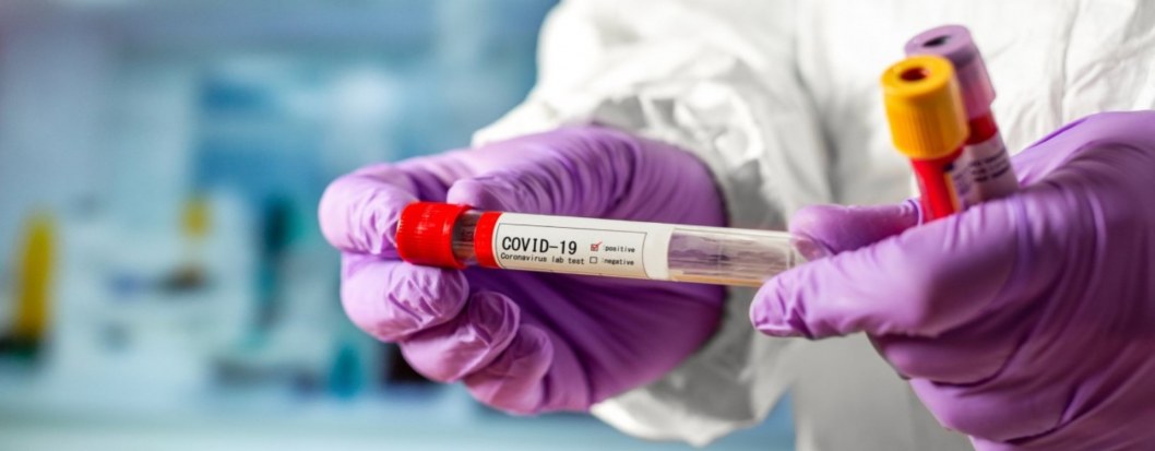 Как в Днепре помогают разрабатывать вакцину от коронавируса (ВИДЕО)