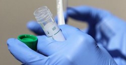 Так же как и вчера: свежая статистика коронавируса в Украине - рис. 8