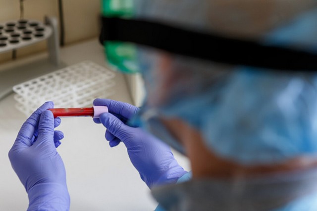 В Днепре менее 1% жителей прошли ИФА-тест на коронавирус - рис. 1