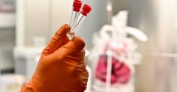 Актуальная статистика: в Днепре зафиксированы новые случаи коронавируса - рис. 14