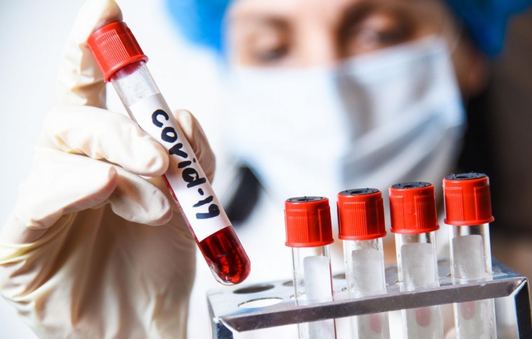 Статистика COVID-19 на 23 сентября в Днепре: коронавирусом за сутки заразились 198 человек - рис. 1