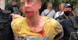 В Днепре на улице мужчина взорвал гранату: есть пострадавшие - рис. 4