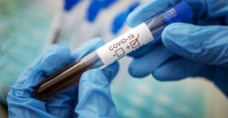 Украина вышла на второе место в Европе по количеству смертей от коронавируса - рис. 1
