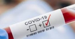 Вспышка коронавируса в Днепре связана с социальной активностью студентов - эксперт - рис. 18