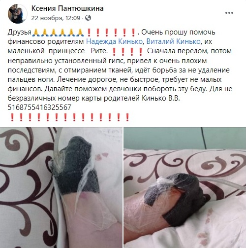 В Днепре на девочку упал бетонный забор: она может остаться без пальцев - рис. 2