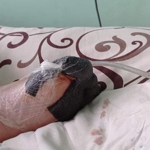 В Днепре на девочку упал бетонный забор: она может остаться без пальцев - рис. 1