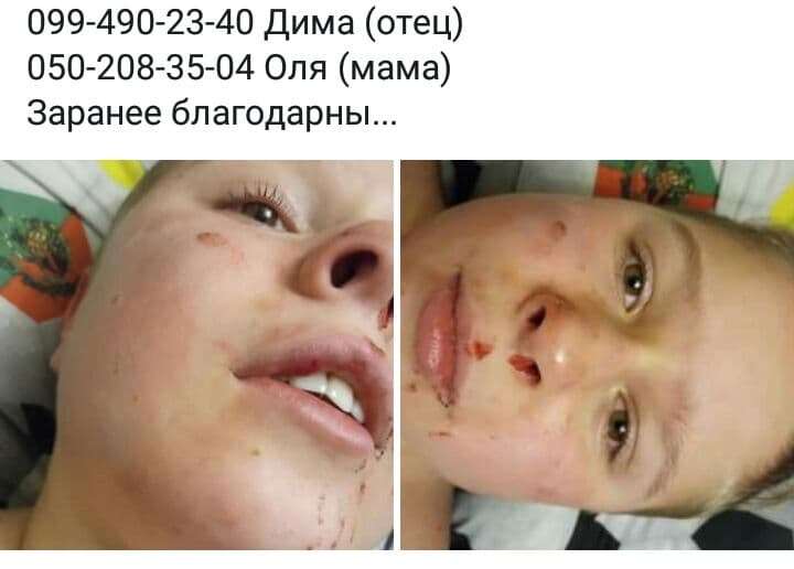В Днепре группа подростков избила 12-летнего мальчика - рис. 2