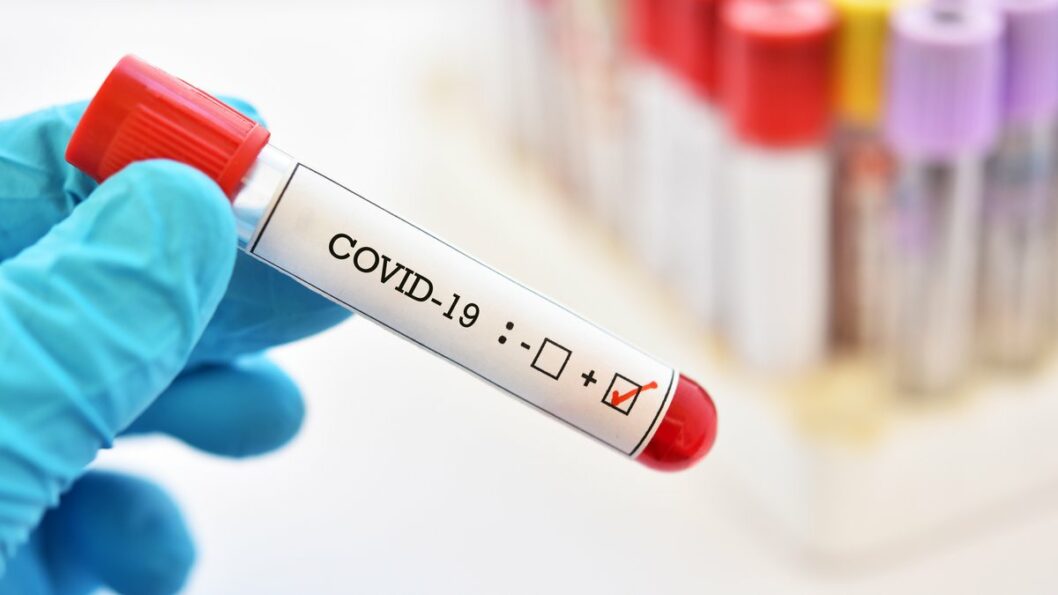 Статистика COVID-19 на 25 ноября в Днепре: коронавирусом за сутки заразились 313 человек - рис. 1