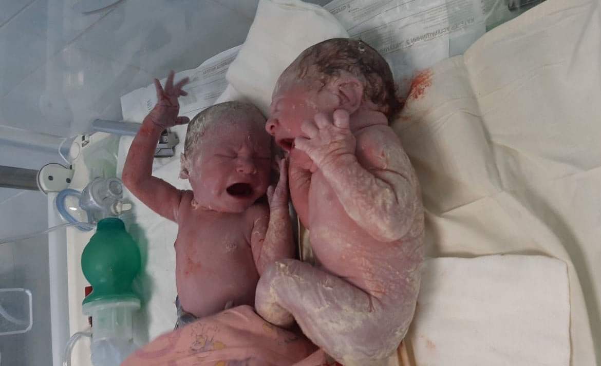 В Днепре женщина с COVID-19 родила двух здоровых младенцев - рис. 2