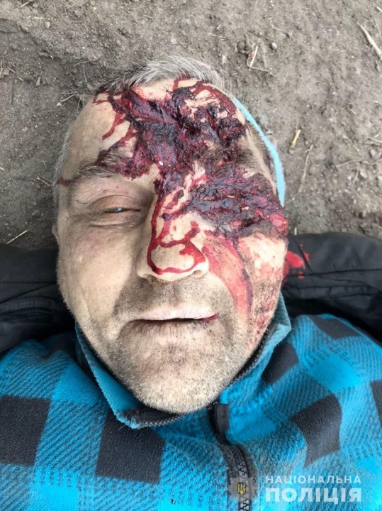 Помогите опознать: на Днепропетровщине водитель насмерть сбил пенсионера и сбежал (18+) - рис. 2