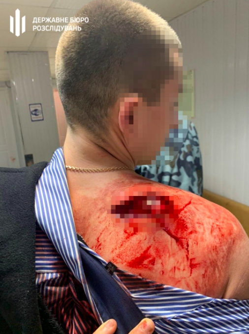 Стрельба и поножовщина в Днепре: один из участников оказался полицейским (ФОТО +18) - рис. 1