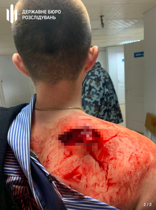 Стрельба и поножовщина в Днепре: один из участников оказался полицейским (ФОТО +18) - рис. 2