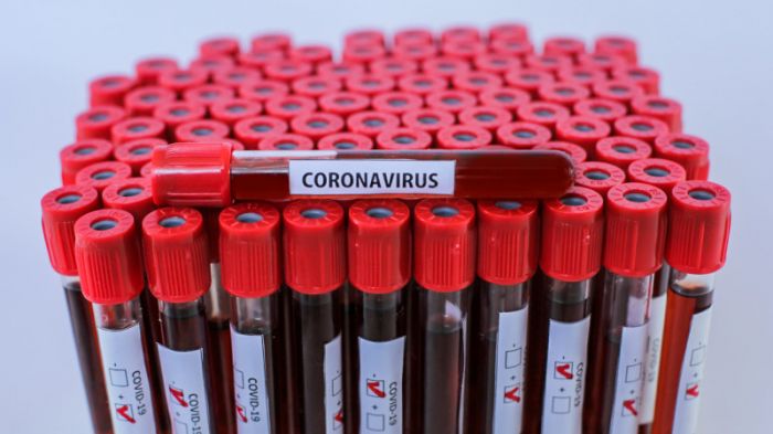 Где в Днепре можно сдать бесплатный тест на коронавирус (АДРЕСА) - рис. 1
