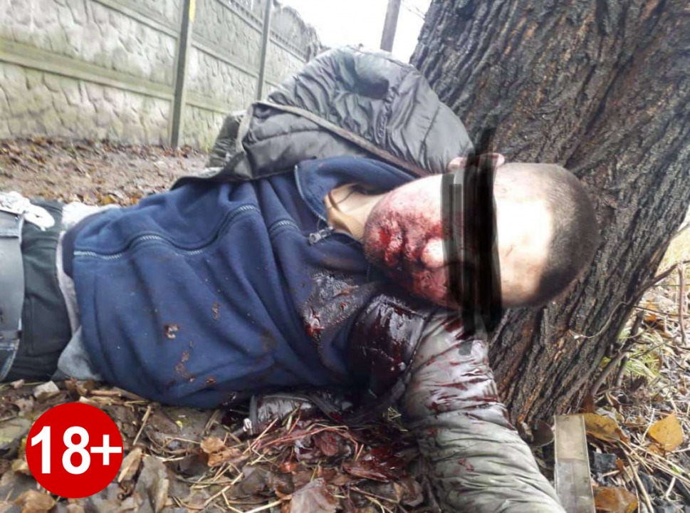 В Павлограде расправились с мужчиной, взорвав петарду у него во рту (ФОТО 18+) - рис. 1