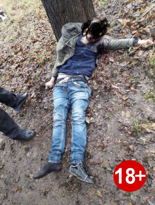 В Павлограде расправились с мужчиной, взорвав петарду у него во рту (ФОТО 18+) - рис. 2