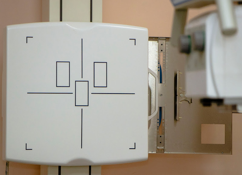 В Днепре в клинической больнице № 6 появился цифровой рентгенаппарат - рис. 3