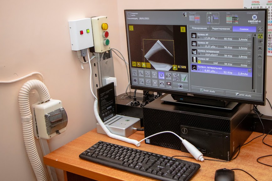В Днепре в клинической больнице № 6 появился цифровой рентгенаппарат - рис. 6