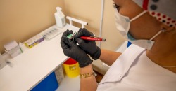 Министр здравоохранения Степанов рассказал о возможных побочных эффектах после вакцинации - рис. 19