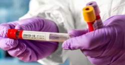 МОЗ внесло изменения в протокол лечения коронавируса - рис. 20