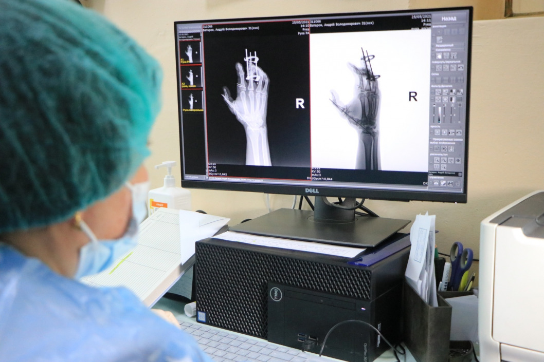 Снимок за 3 минуты: в днепровской больнице заработал новый рентген-аппарат - рис. 2