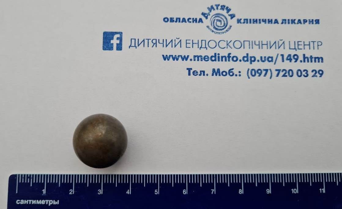 В Днепре спасли подростка, проглотившего фрагмент конструктора - рис. 3