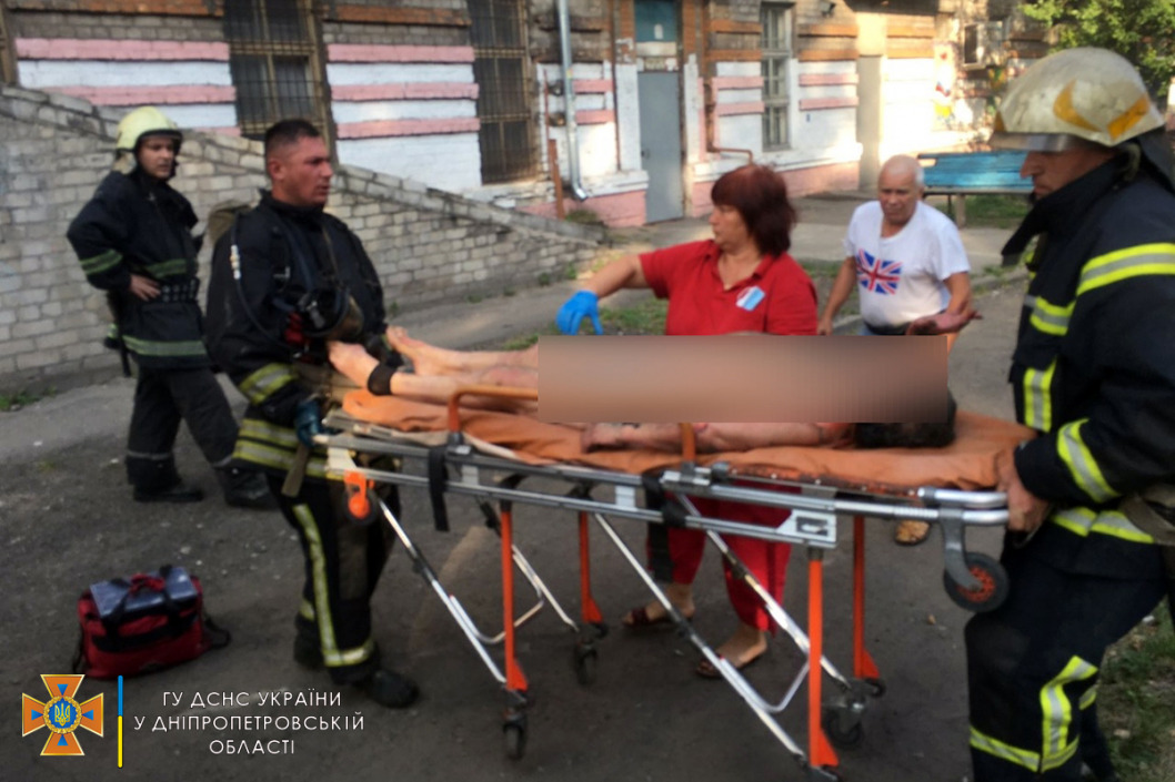На Днепропетровщине во время пожара женщина получила 98% ожогов тела - рис. 2