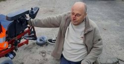 Из-за ям: в Новомосковске мужчина выпал из инвалидной коляски и разбил лицо - рис. 22