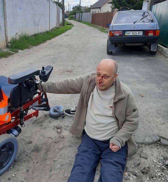 Из-за ям: в Новомосковске мужчина выпал из инвалидной коляски и разбил лицо - рис. 1