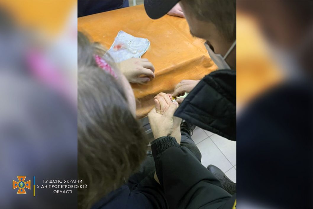 Коварное украшение: в Днепре спасатели помогли 17-летнему подростку снять кольцо с пальца - рис. 2