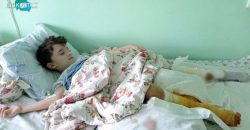 Годовщина аварии в Днепре: как себя чувствует 9-летний мальчик, попавший под колеса фуры - рис. 2