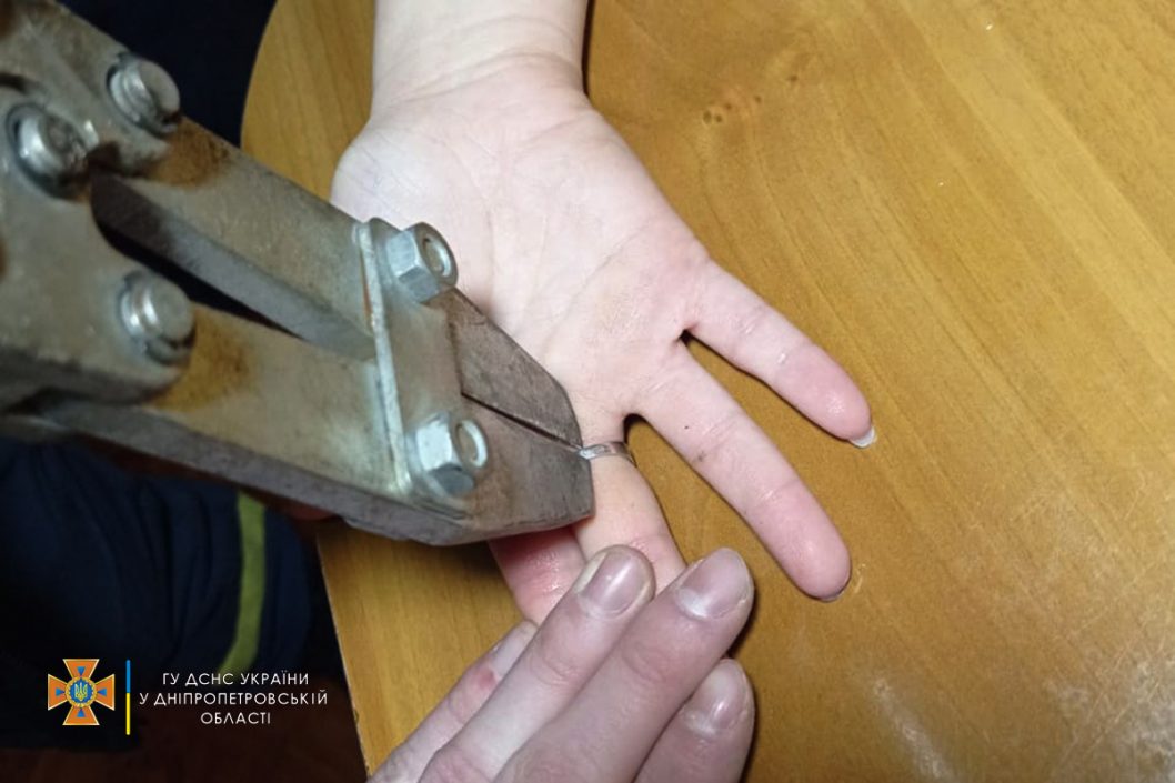 Коварное украшение: в Днепре спасатели сняли кольцо с пальца девушки - рис. 1