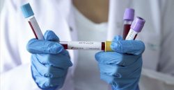 Новый антирекорд по Украине и более 800 заболевших коронавирусом в Днепре - рис. 14