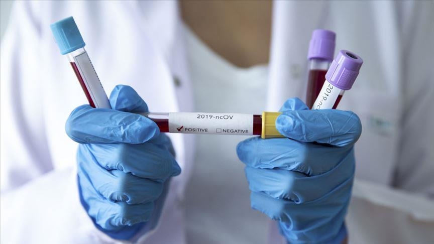 Новый антирекорд по Украине и более 800 заболевших коронавирусом в Днепре - рис. 1